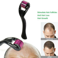 Skin Therapy Derma Roller With 540 Micro Needle