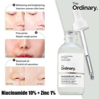 Niacinamide Serum 30ml Oil Control Blemish Reduction image 1 PanguDeals Pakistan