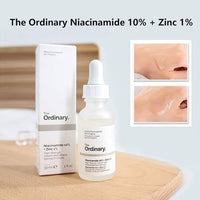 Niacinamide Serum 30ml Oil Control Blemish Reduction image 3 PanguDeals Pakistan